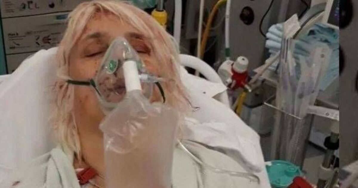 Kobieta, którą jej agresywny były partner dźgnął nożem 29 razy, mówi, że „cieszy się, że nie żyje”