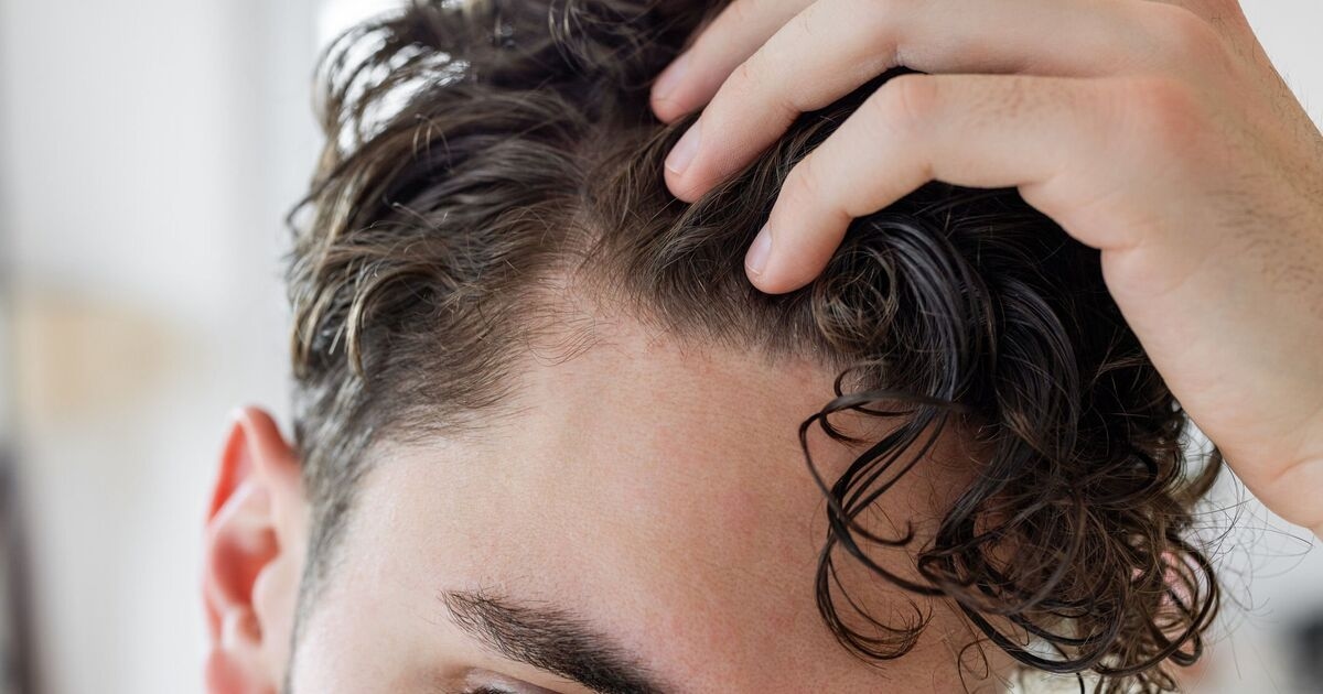 Arzt sagt, Mounjaros Nebenwirkung Haarausfall könnte vermeidbar sein