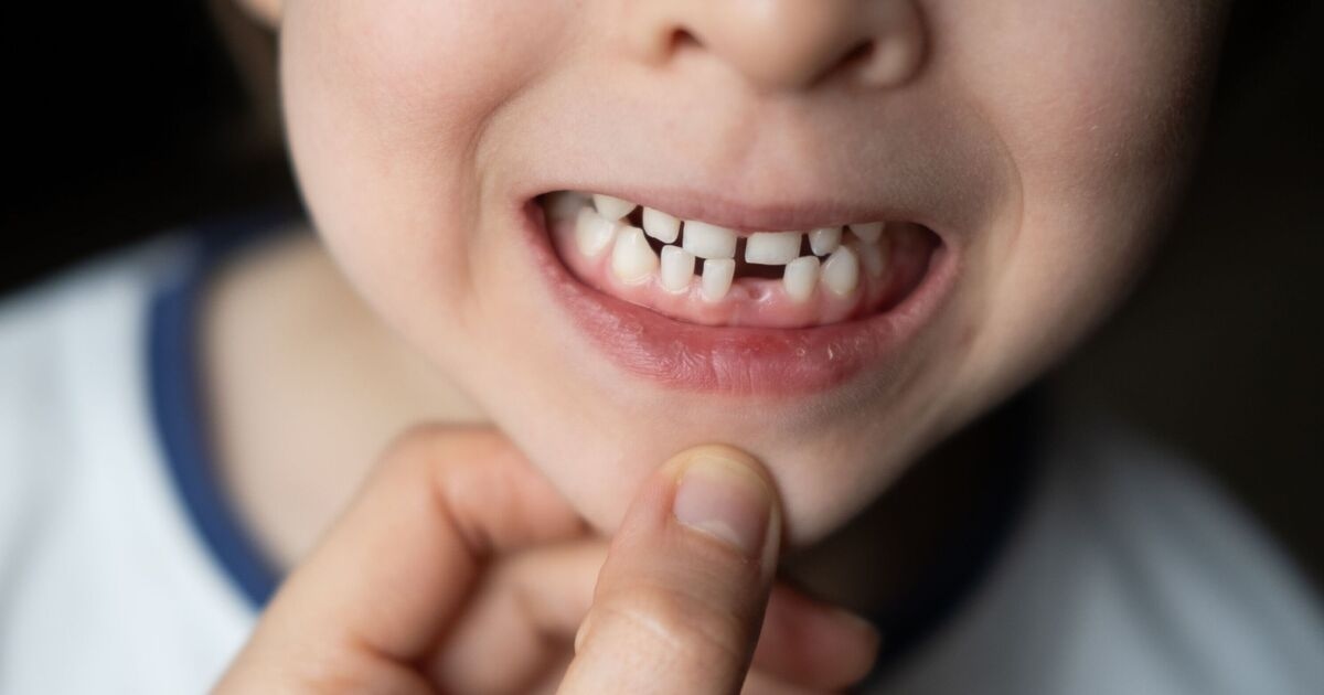 I’m a dentist – never ignore these symptoms in children