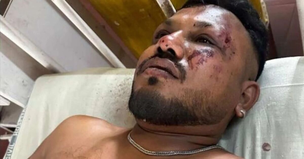 Furia cuando un famoso actor acusa a un superviviente del milagroso accidente de Air India de mentir