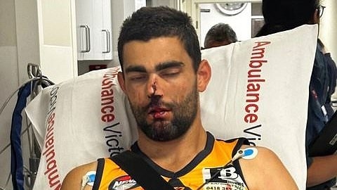 Footy club makes urgent appeal after horror facial injury that has left player in dire straits six weeks after he was hospitalised