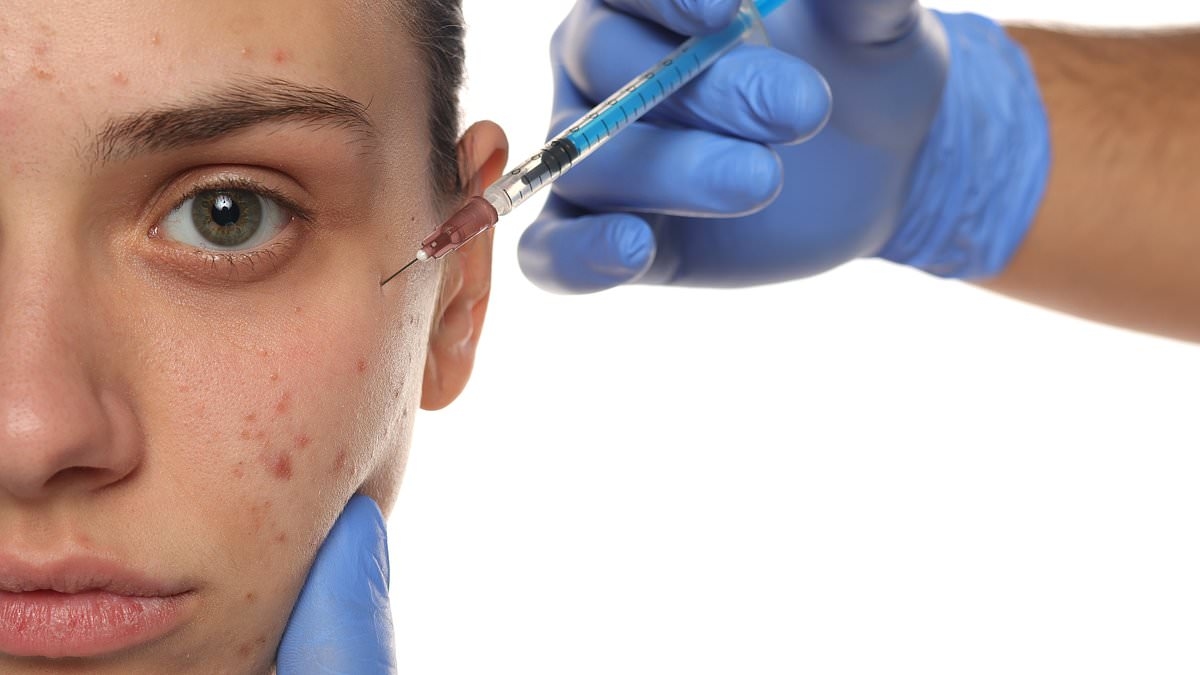 De nieuwe prik die uw acne permanent kan genezen... en zelfs kan voorkomen dat er überhaupt puistjes ontstaan, door zich te richten op patiënten met een familiegeschiedenis