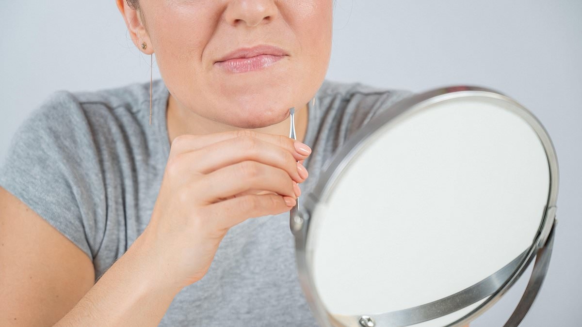 What women can do about those stubborn wiry chin hairs - and when you MUST see your doctor, DR RAJ ARORA
