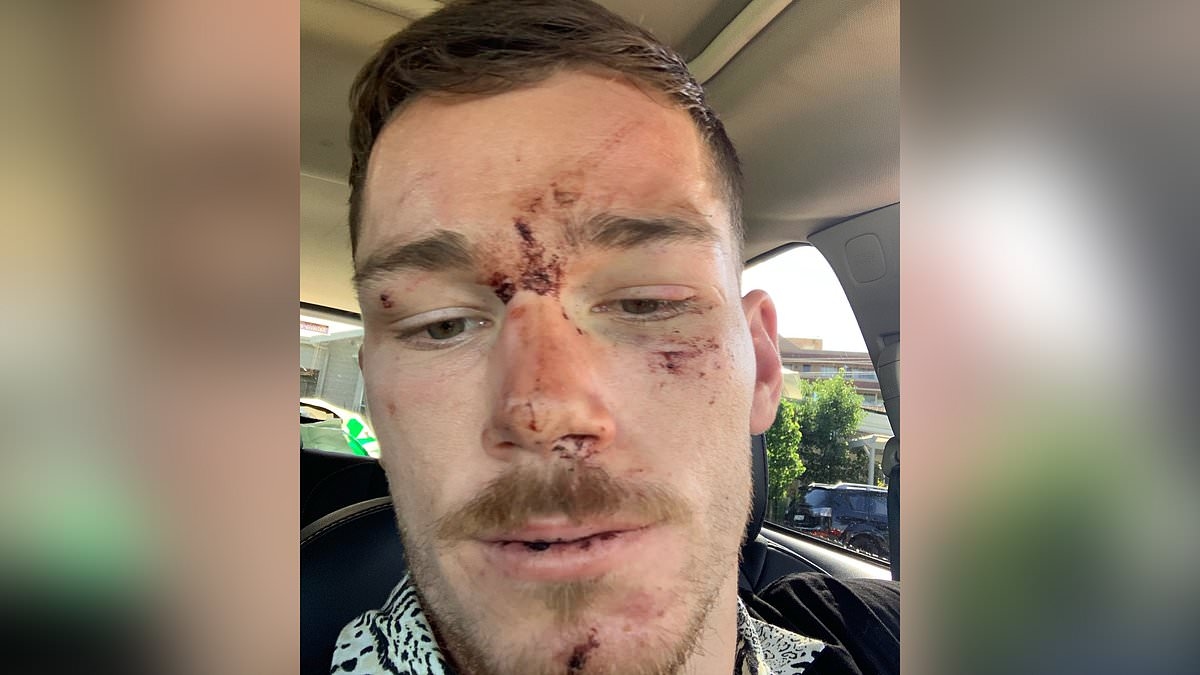 Cop reveals why he blew the whistle on his fellow officers after they allegedly bashed NRL star Tom Starling unconscious