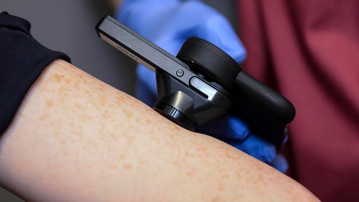 Revolutionary new AI smartphone app can spot deadly skin cancers