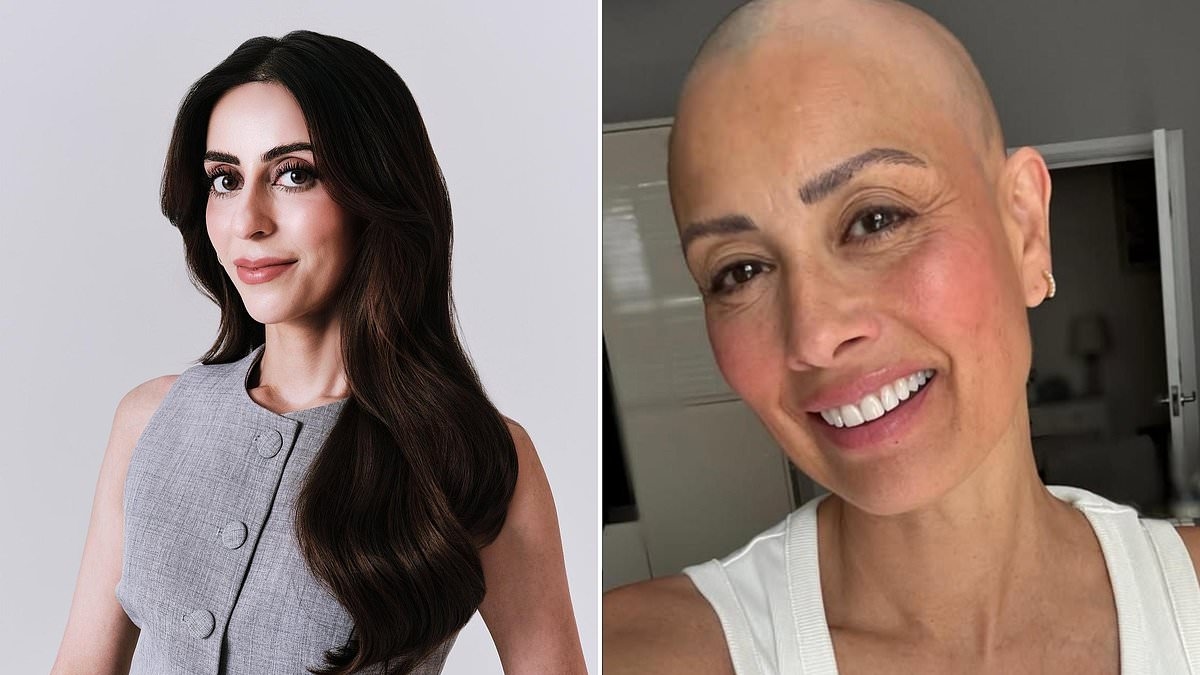 This is the REAL reason women like Melanie Sykes are losing their hair - and the steps you must take to stop it happening to YOU: DR AAMNA ADEL