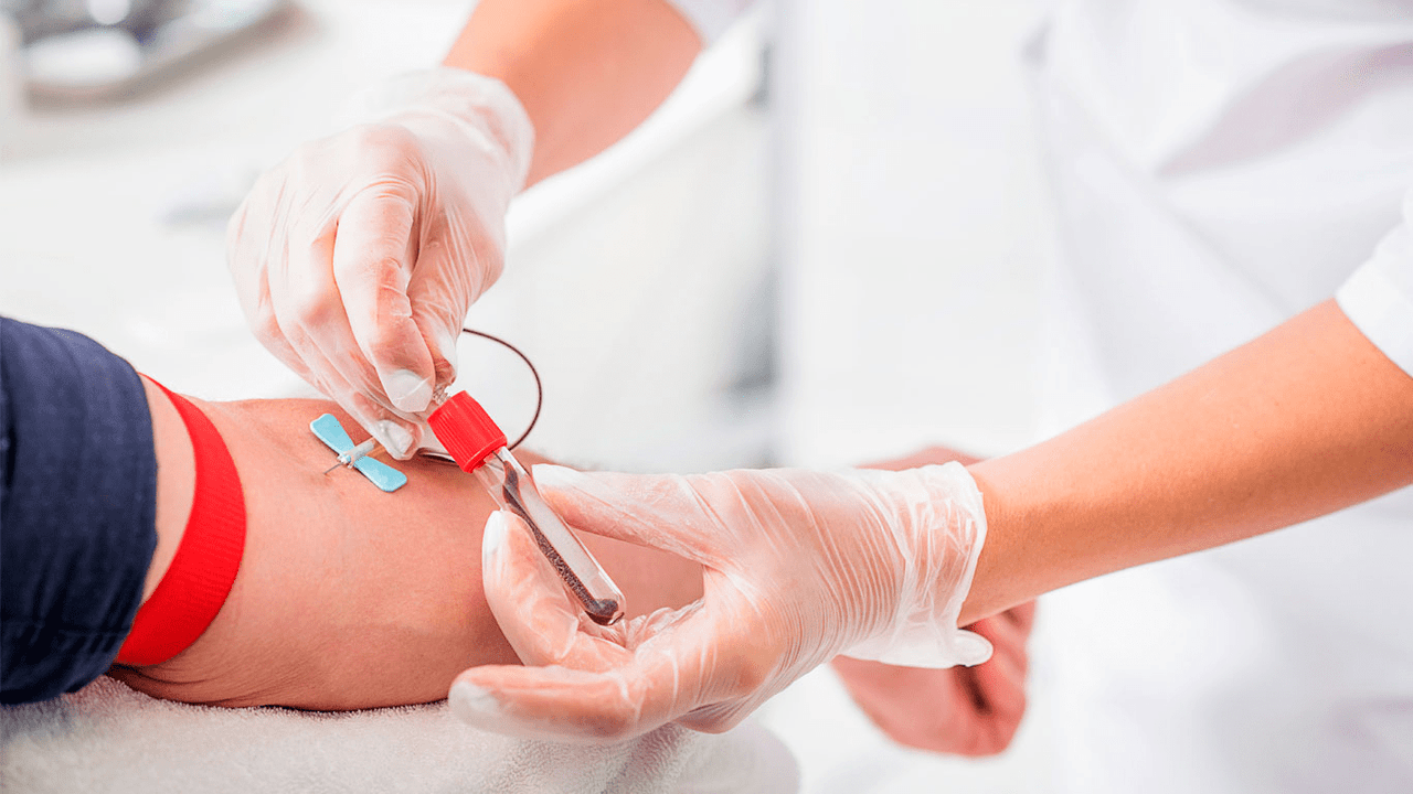 Análisis de sangre de nueva generación mejora la detección del cáncer de próstata agresivo