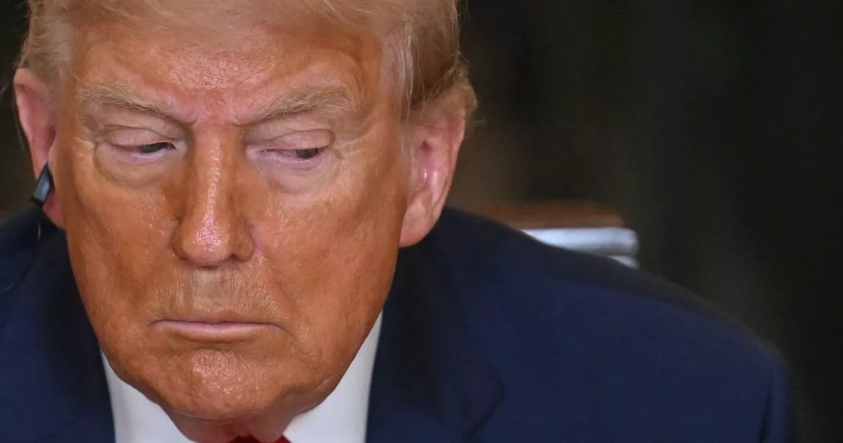 Insuficiencia venosa crónica: Síntomas y tratamiento de la afección que afecta a Donald Trump