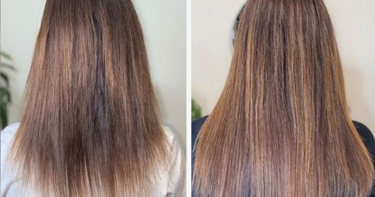 Hair loss sufferer says 'hairdresser couldn't believe' growth with beauty bundle