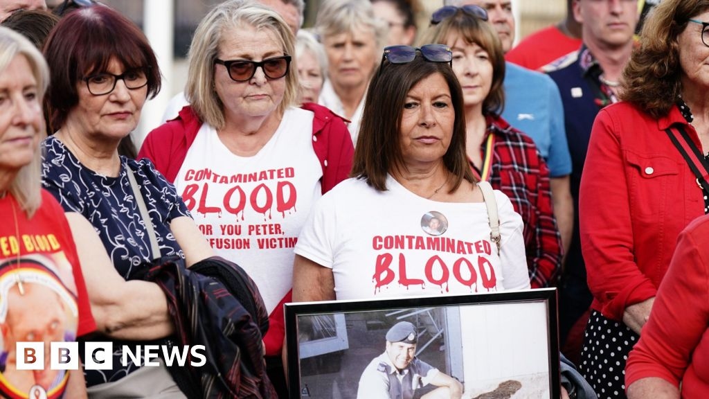 'Cambios sustanciales' en los pagos por sangre infectada