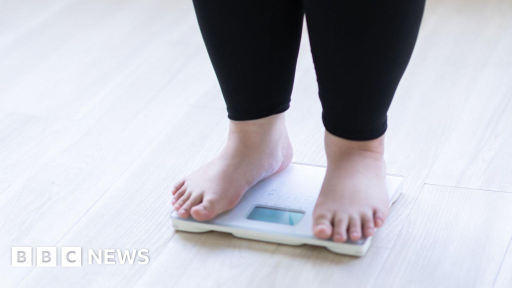 Çocuk obezite kliniklerinde 50'nin üzerinde BMI görülüyor