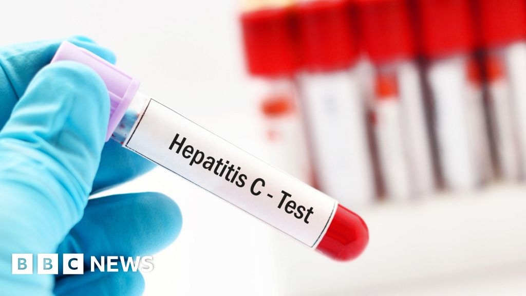 GP patients to help NHS find more infected blood victims