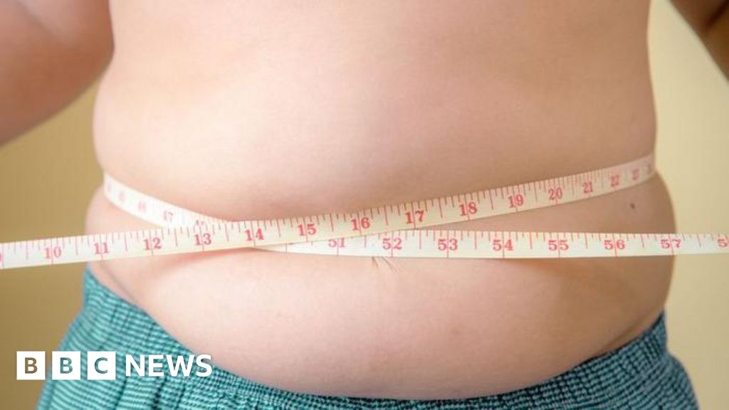 Hay más niños obesos que con bajo peso, dice Unicef