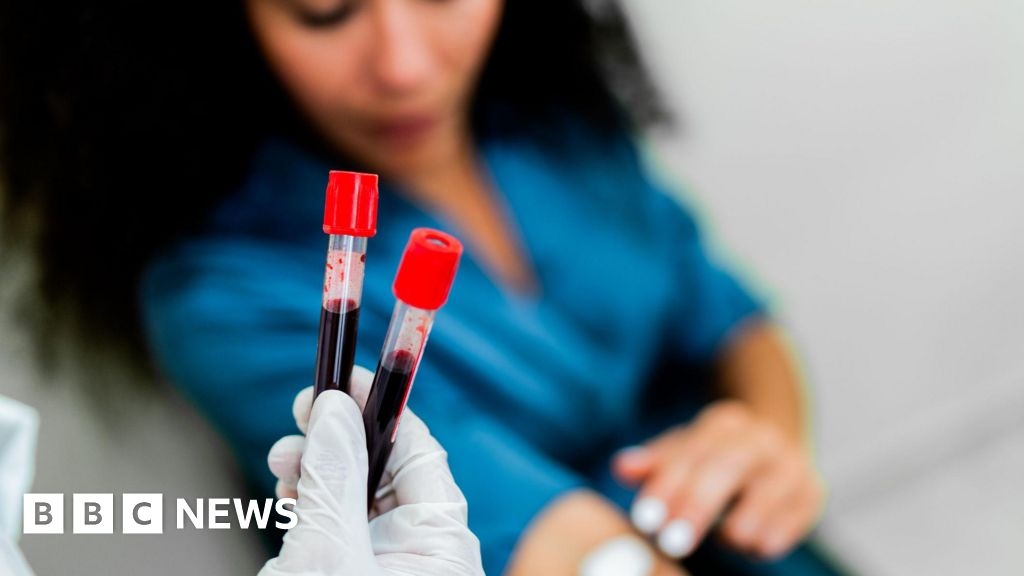 Résultats encourageants d'un test sanguin pour 50 cancers