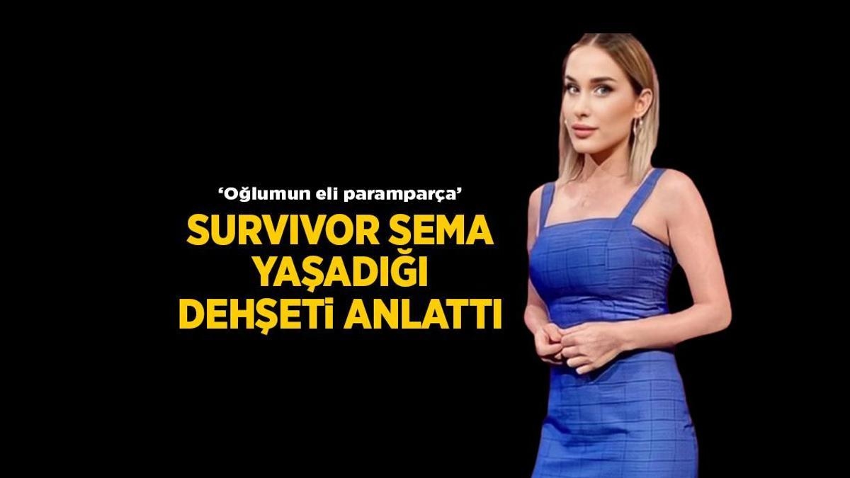Son Haberler: Survivor Sema Aydemir köpek dehşetini anlattı! 'Oğlum Ali'nin eli paramparça'