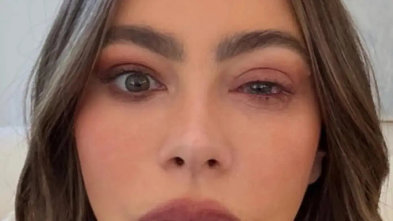 "Podría llegar a quitar visión de manera permanente": La alergia ocular que ha sufrido Sofía Vergara, explicada por un oftalmólogo
