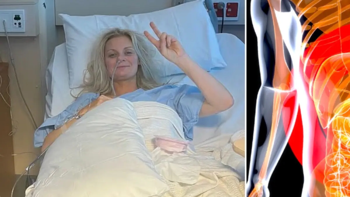 Mujer pensó que tenía un virus estomacal y cuando fue al médico le diagnosticaron un cáncer avanzado: ‘Estuve tres días postrada en cama vomitando’