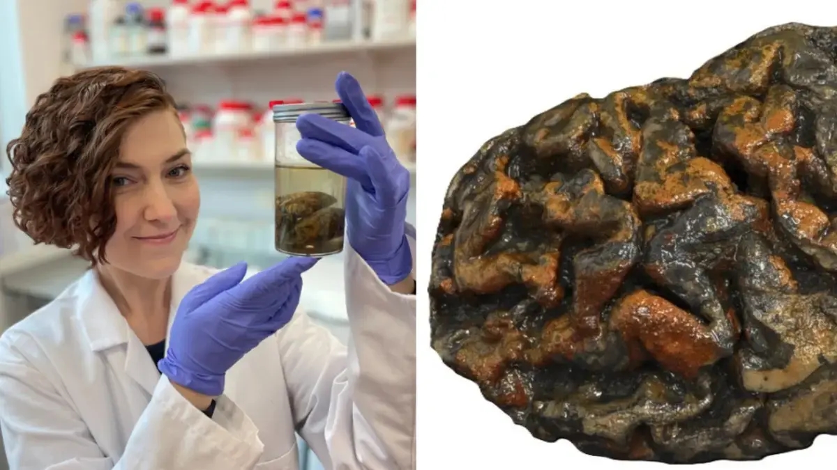 La científica británica que estudia cerebros milenarios para descifrar su resistencia al paso del tiempo: 'La naturaleza progresiva de la demencia'