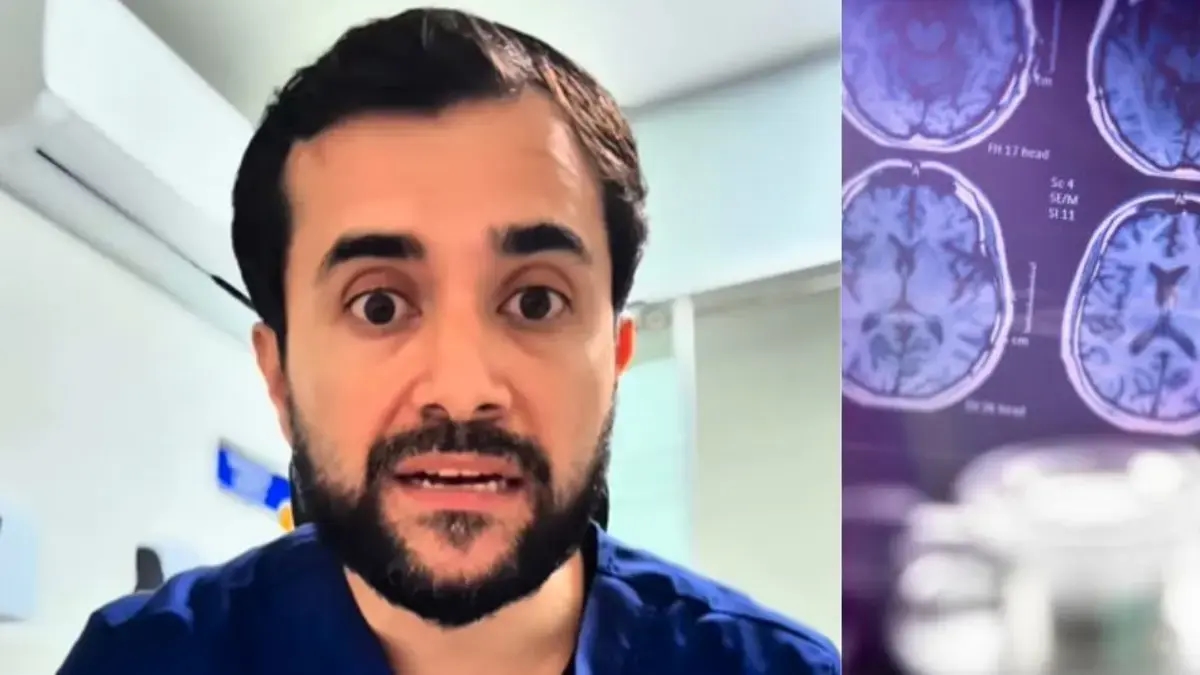 Leonardo Bello, neurologo: "Per me il sintomo iniziale dell'Alzheimer è la perdita di massa muscolare"