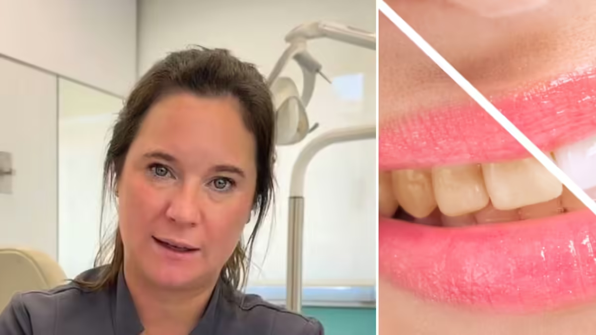 An orthodontist explains why having 'yellow teeth isn't just due to poor hygiene' and what to do to improve their color.