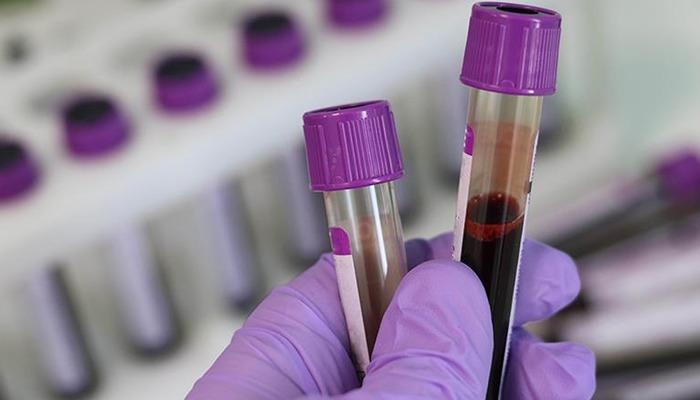 Genetische Gefahr ... Vor der Ehe sind Tests ein Muss: Thalassämie verbreitet sich unbemerkt! Experten warnen: „Thalassämie-Trägerrate liegt bei 2,1 Prozent“