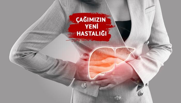 Новая болезнь века: жировая дистрофия печени! За последние 30–40 лет он неуклонно растет! Что вызывает ожирение печени? Предупреждения экспертов...
