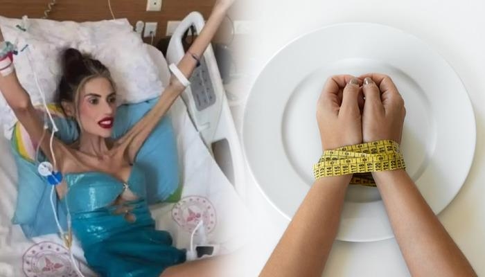Non è una malattia da fame, è un disturbo psicologico mortale! Cos'è l'anoressia nervosa? Come si cura?