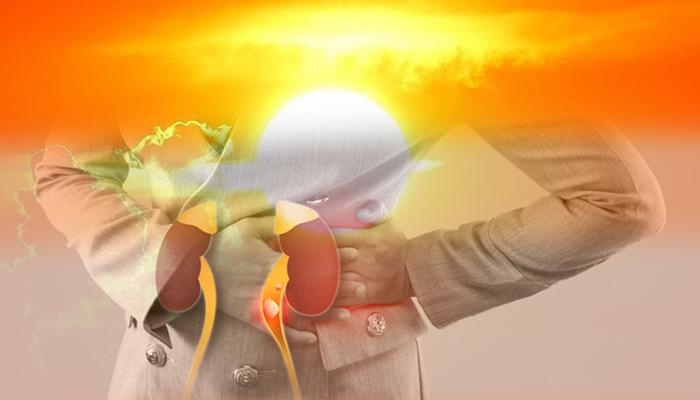 Yaz ayında böbreklerinizi kaybetmeyin! Sıcak havalarda bu önerilere dikkat: Taş oluşma riskini artırıyor! Uzmandan uyarılar...