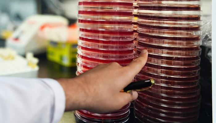 Les microbes oculaires ont été transportés dans l'espace : « Le microbiome oculaire a été étudié dans l'espace »