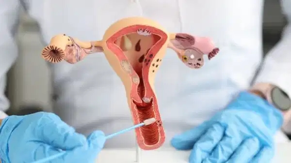 Wichtiger Hinweis eines Experten: „Gebärmutterhalskrebs verursacht erst im fortgeschrittenen Stadium Symptome.“