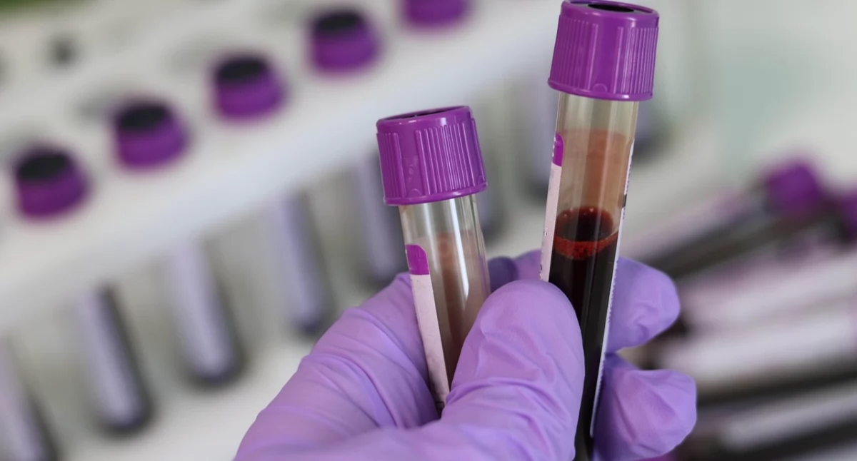 Il Sejm dice "no" ai giorni di riposo flessibili per i donatori di sangue onorari
