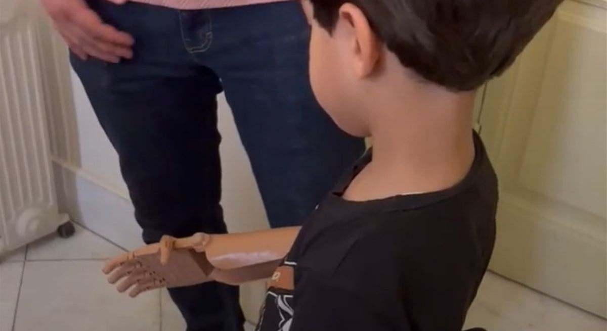 Ayúdame3D: die spanische NGO, die 3D-gedruckte Prothesen für Kinder mit Amputationen in Gaza entwirft und liefert.