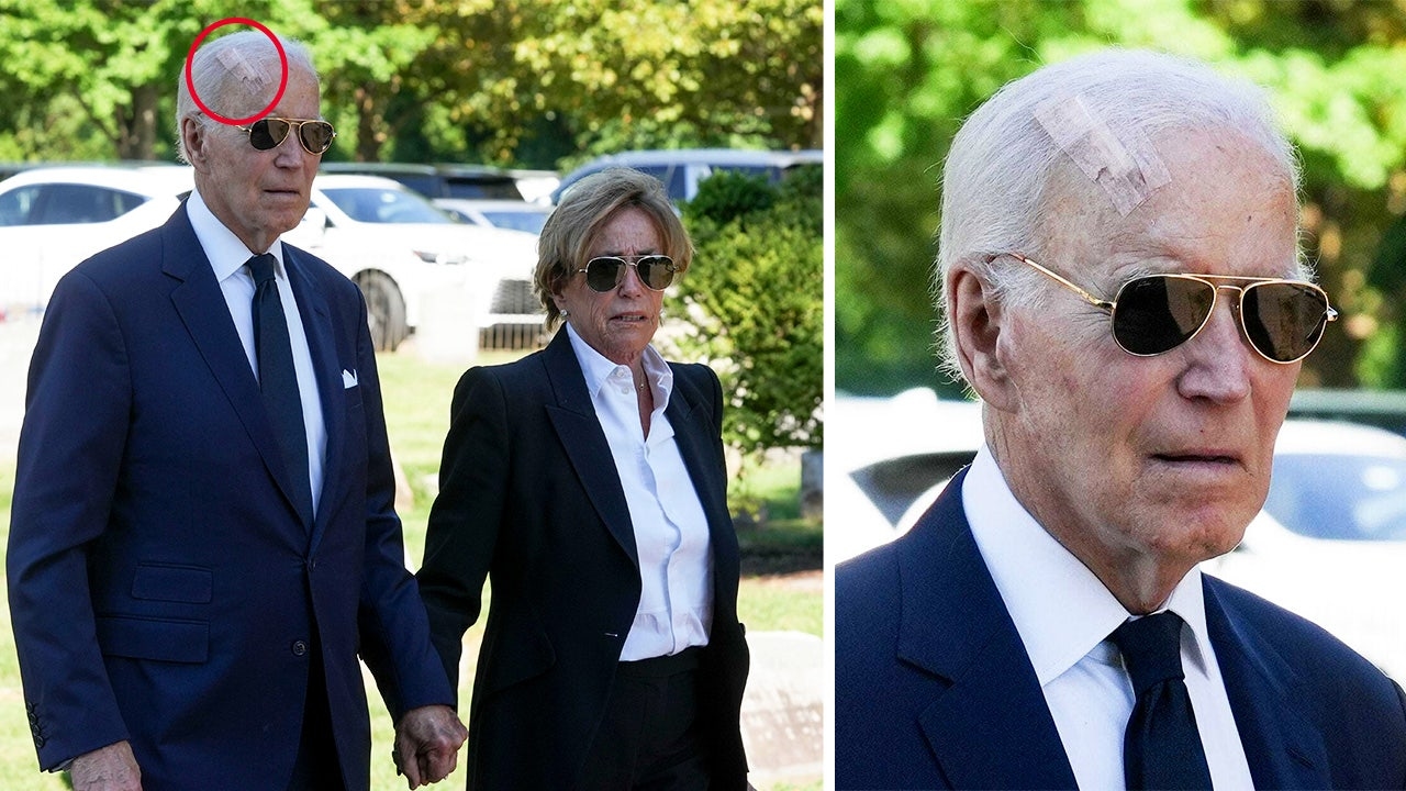 Biden fue visto con una venda gigante en la cabeza después de una cirugía para tratar el cáncer de piel.