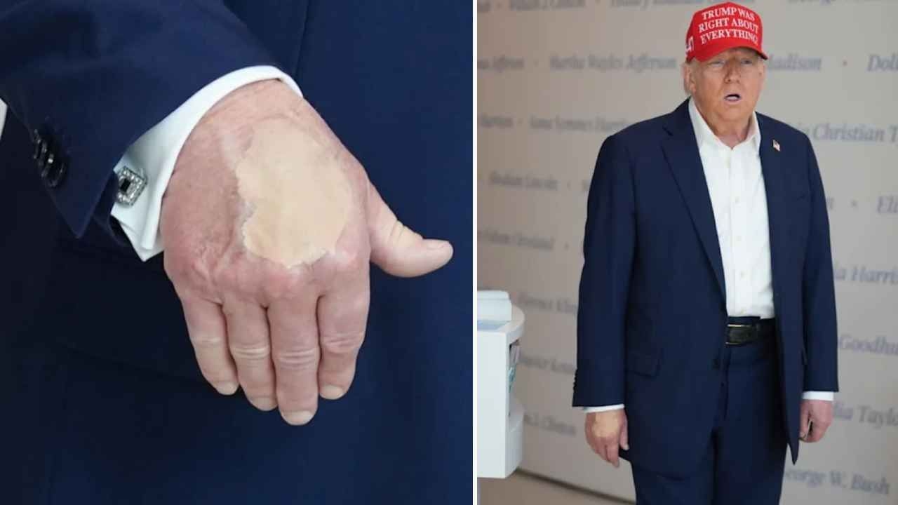 A maquiagem nas mãos virou assunto! Declaração dos EUA sobre a saúde de Trump