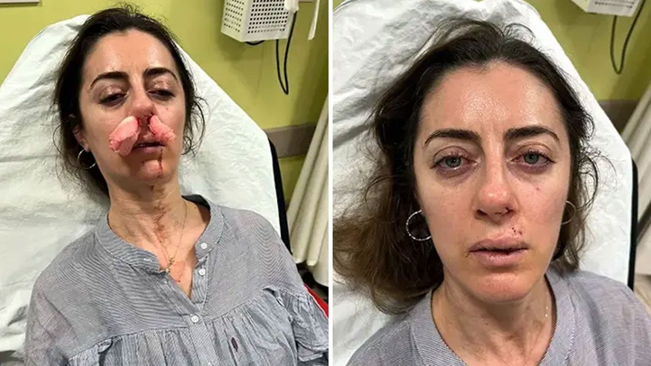 Eşinin sevgilisi sanıp darp etmişti! Otomobil kapısı silah sayıldı