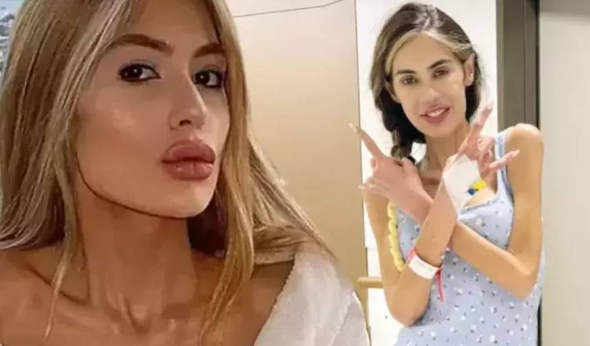 Nihal Candan wog weniger als 29 Kilo! Sie wurde auf die Intensivstation gebracht