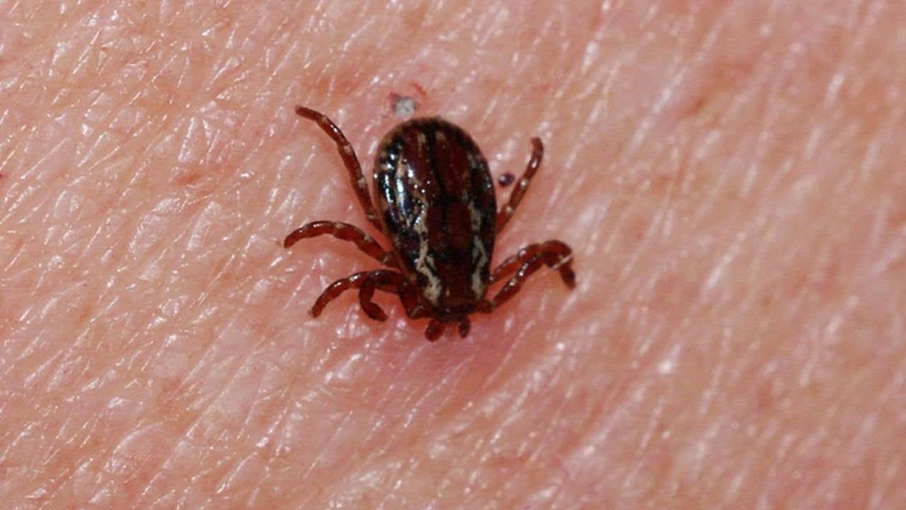 Una persona que fue tratada por sospecha de CCHF en Kayseri falleció.