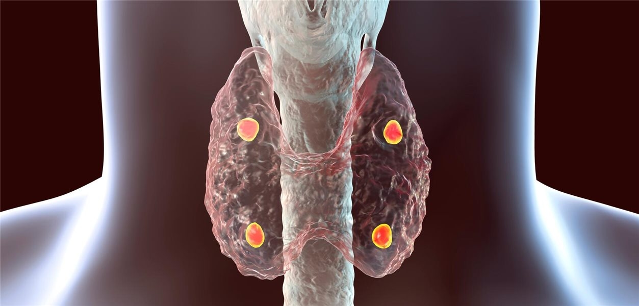 Bei Hypoparathyreoidismus primär aktives Vitamin D geben!
