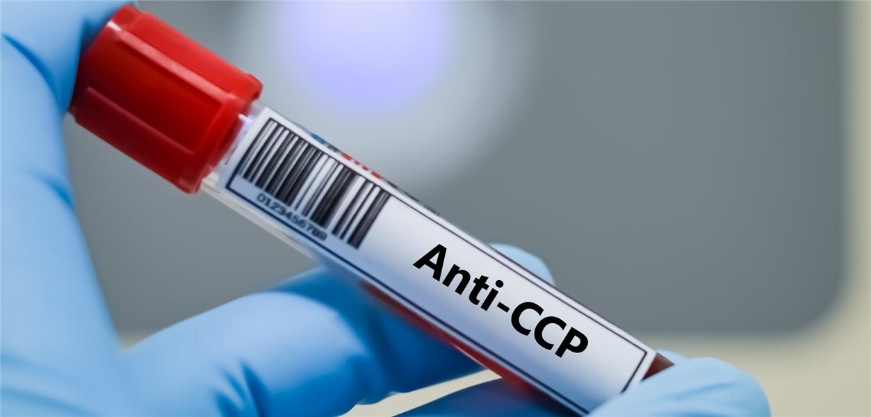 Bildgebung bringt wenig für die Vorhersage einer späteren Rheumatoiden Arthritis