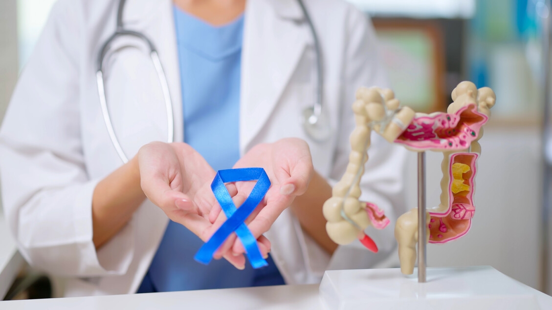 Una nuova strategia rende i tumori del colon-retto sensibili all'immunoterapia