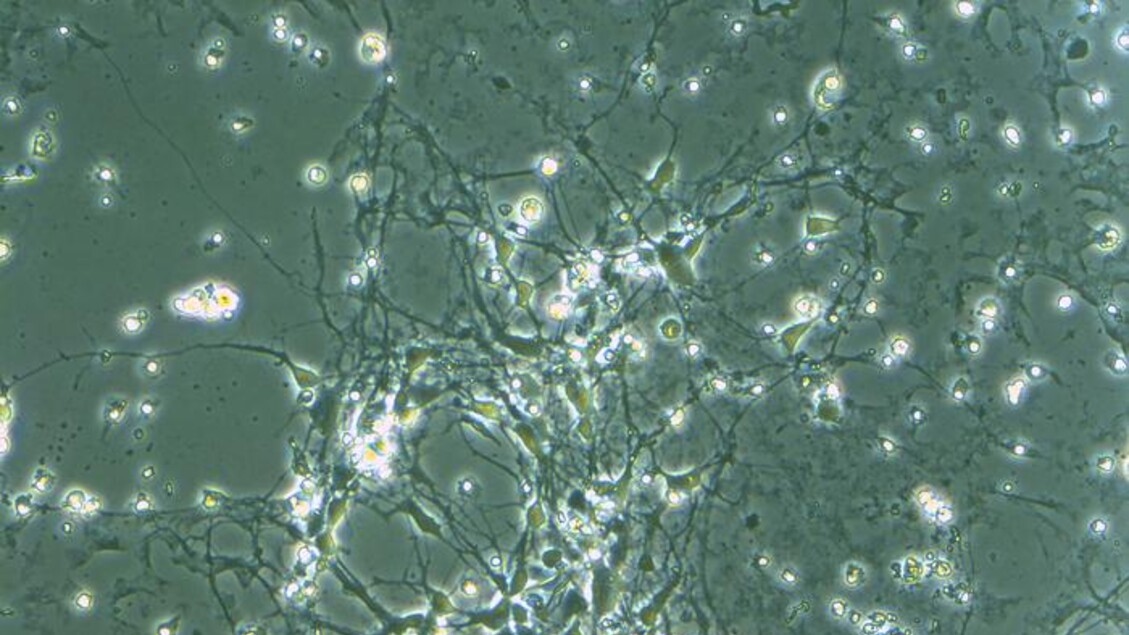 Un banco de genes con 63 mutaciones para estudiar el autismo