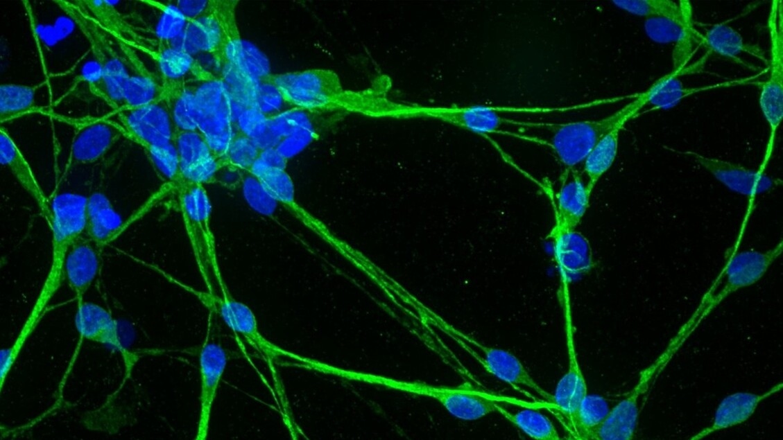 3D-printed organoids for the personalized medicine of the future