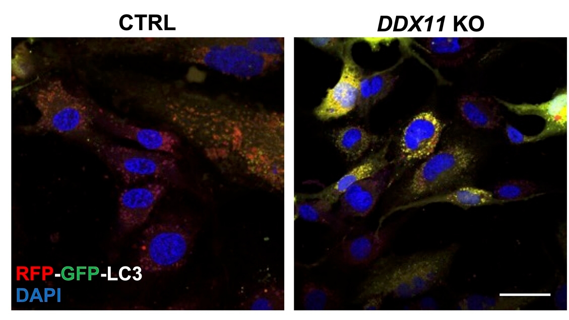 A protein with a double duty against neurodegeneration
