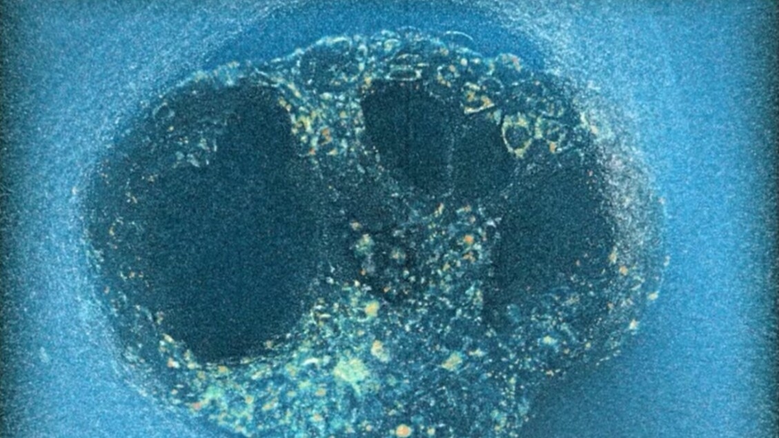 Implantatie van menselijk embryo voor het eerst gefilmd VIDEO