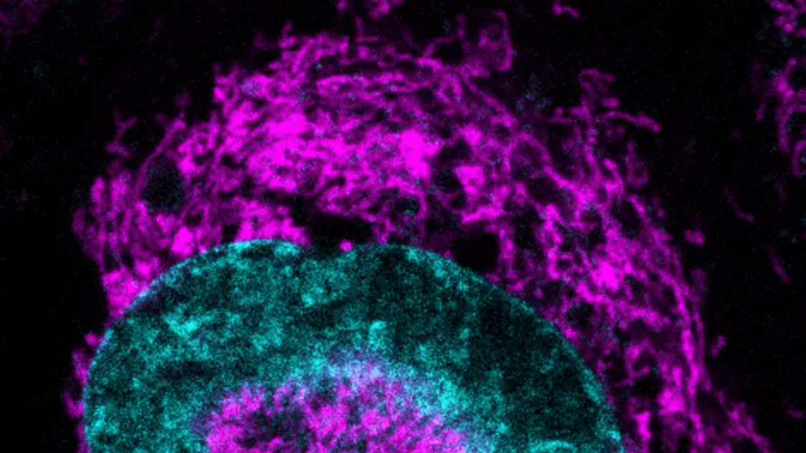 As células cancerígenas se iluminam quando esmagadas, é uma defesa