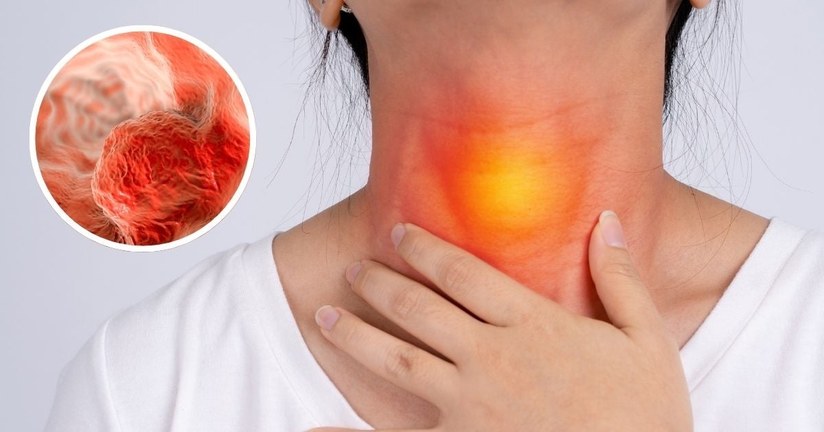 Vous souffrez de reflux et buvez des boissons chaudes ? Voici les facteurs qui pourraient déclencher ce cancer