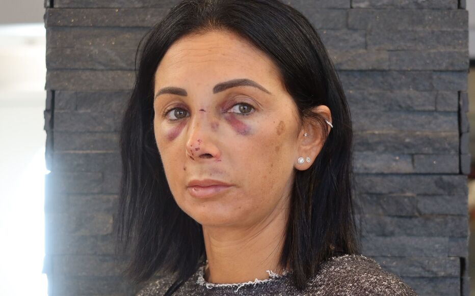 "Sabíamos que querían mi reloj, pero ¿por qué me golpean?": Séverine, óptica de Sarcelles (95), agredida tras el cierre de su tienda (Actualización: Probablemente secuelas permanentes; Ousmane D., de 19 años, podría ser juzgado)