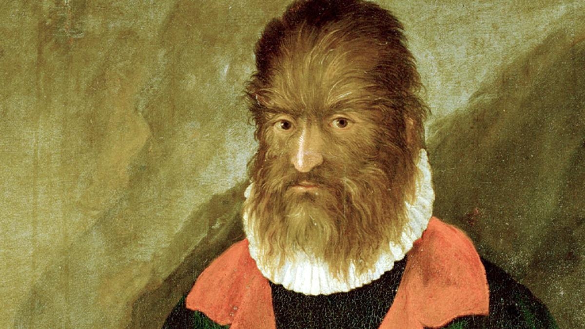 Belki de 'Güzel ve Çirkin'e ilham veren 'Kanarya kurt adamı' Petrus Gonsalvus