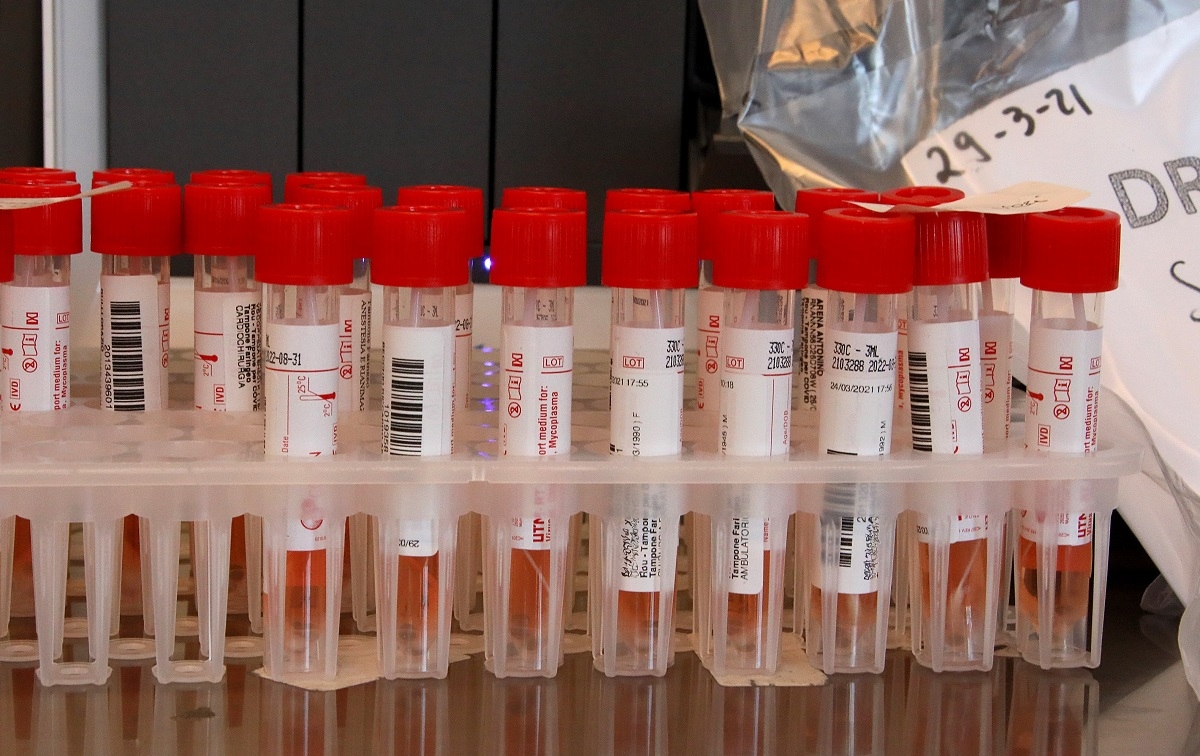 Covid à l'automne et à l'hiver 2025 : les experts mettent en garde contre les infections