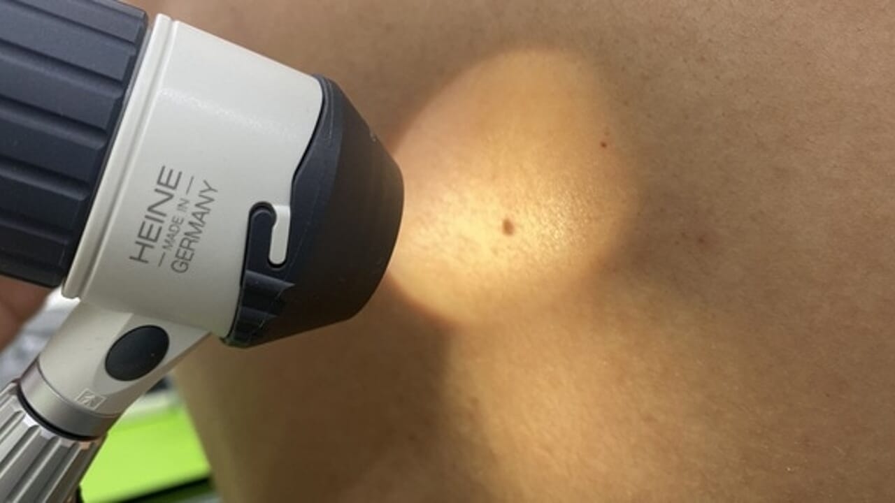 Consulti dermatologici gratuiti per i propri dipendenti: l'iniziativa dell'azienda dell'Alta